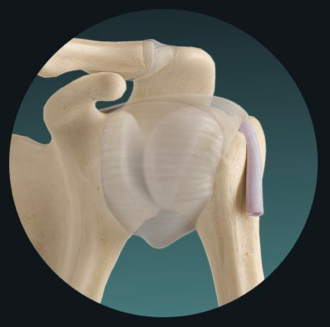 <p>freely moveable</p><p>synovial joints</p><p>also contains accessory ligaments and articular discs (menisci)—pads of fibrocartilage</p>