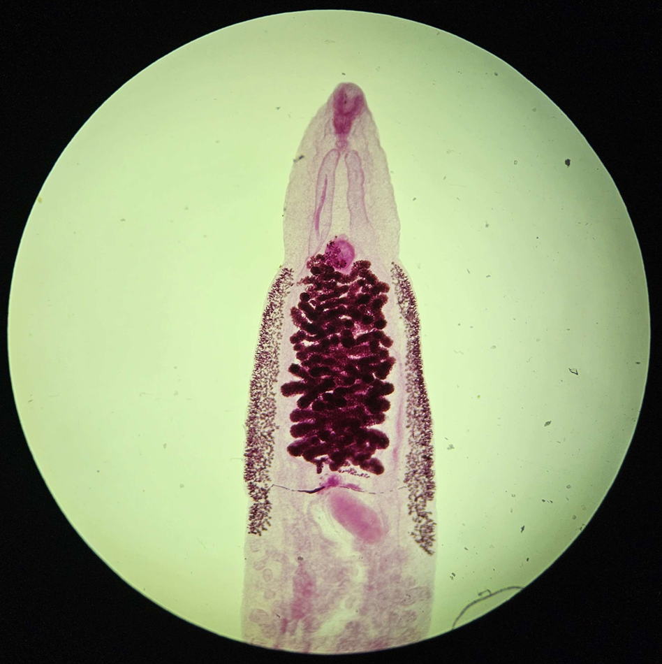 <p><span data-name="microscope" data-type="emoji">🔬</span><span data-name="petri_dish" data-type="emoji">🧫</span><strong><span> </span>Na podstawie zdjęcia preparatu:</strong></p><p></p><ul><li><p><span data-name="book" data-type="emoji">📖</span><span> </span>rozpoznaj gatunek pasożyta;</p></li></ul><p></p><ul><li><p><span data-name="recycle" data-type="emoji">♻</span><span> </span>rozpoznaj wszystkie formy rozwojowe;</p></li></ul><p></p><ul><li><p><span data-name="microbe" data-type="emoji">🦠</span><span> </span>wskaż organelle i cechy charakterystyczne dla danego gatunku;</p></li></ul><p></p><ul><li><p><span data-name="mask" data-type="emoji">😷</span><span> </span>nazwij chorobę, którą pasożyt wywołuje.</p></li></ul><p></p>