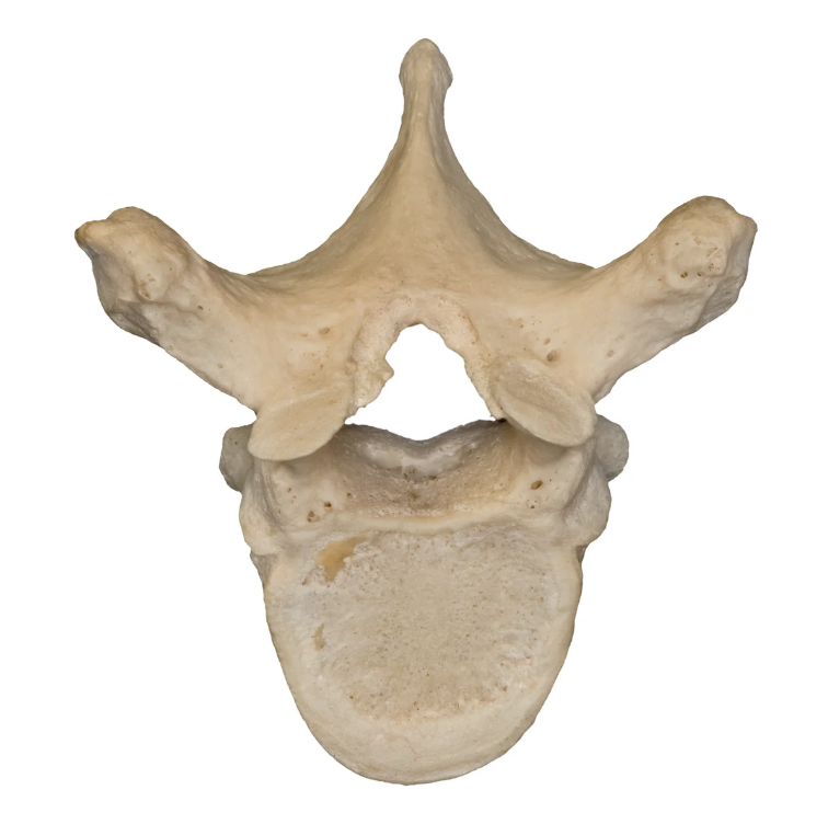 <p>What vertebrae is this?</p>