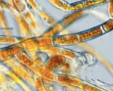 <p>Chlorophyta green algae; subaerial/terrestrial; filamentous; on bark and rock in humid places; protective carotenoid pigments mask chlorophylls; symbiont in many lichen associations</p>