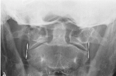 <p>Q what is the name of this measurement? and what is the average + range?</p>