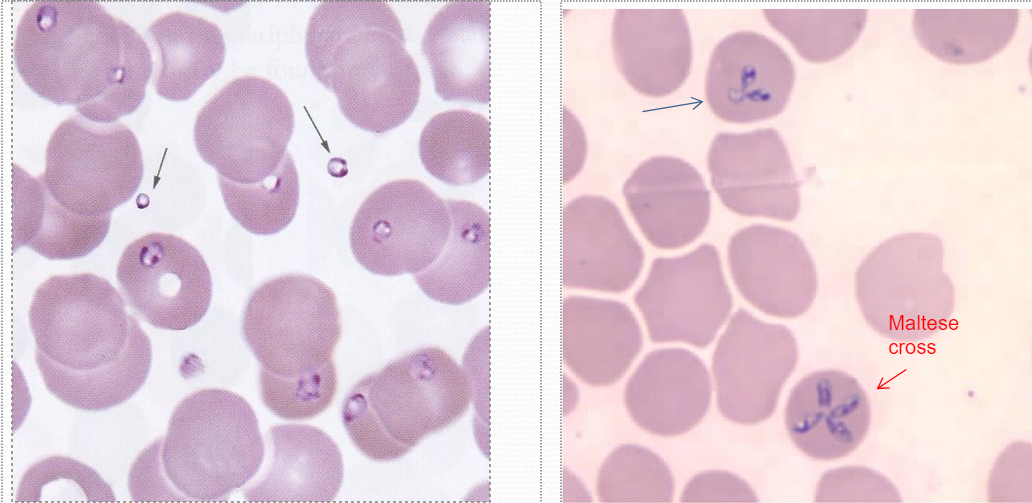<p><span style="color: red">typically lots of reticulocytes in smear bc lyses many rbc (see at 10x)</span></p><p>chromatid dots inside &amp; out of rbc</p><p>bunny ears or maltese cross</p><p>must r/o malaria still</p><p></p>