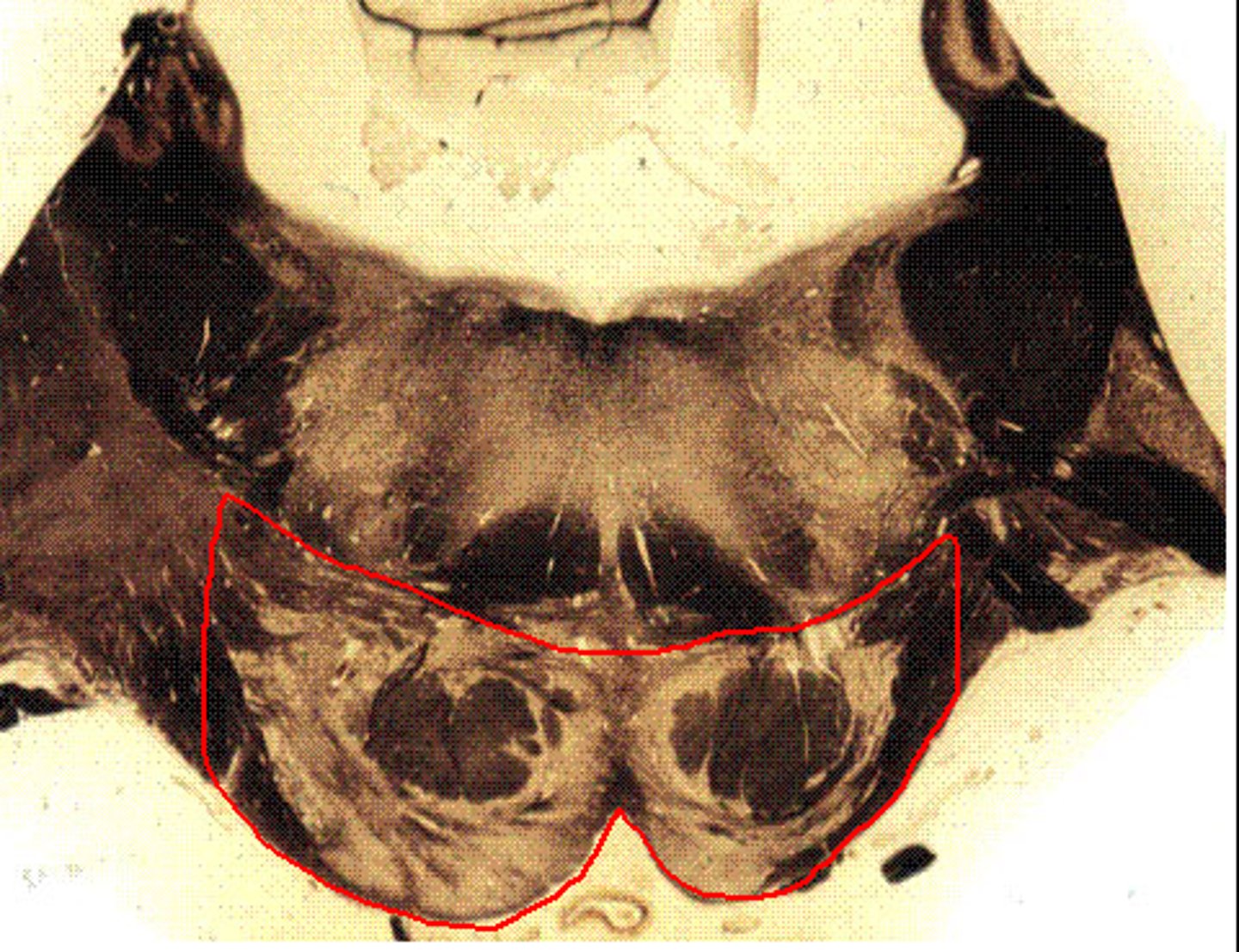 <p>NOTE the fibers running towards the top of the red section, these are more visible as one moves caudally up the pons</p>