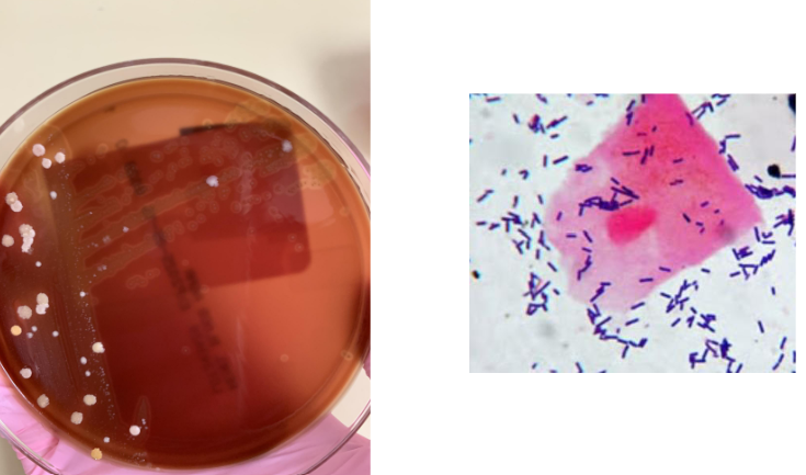 <p>what organism is this most likely</p>