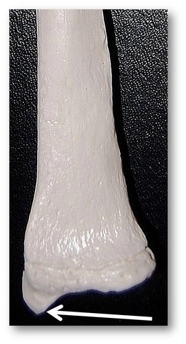 Name this specific part of the radius.