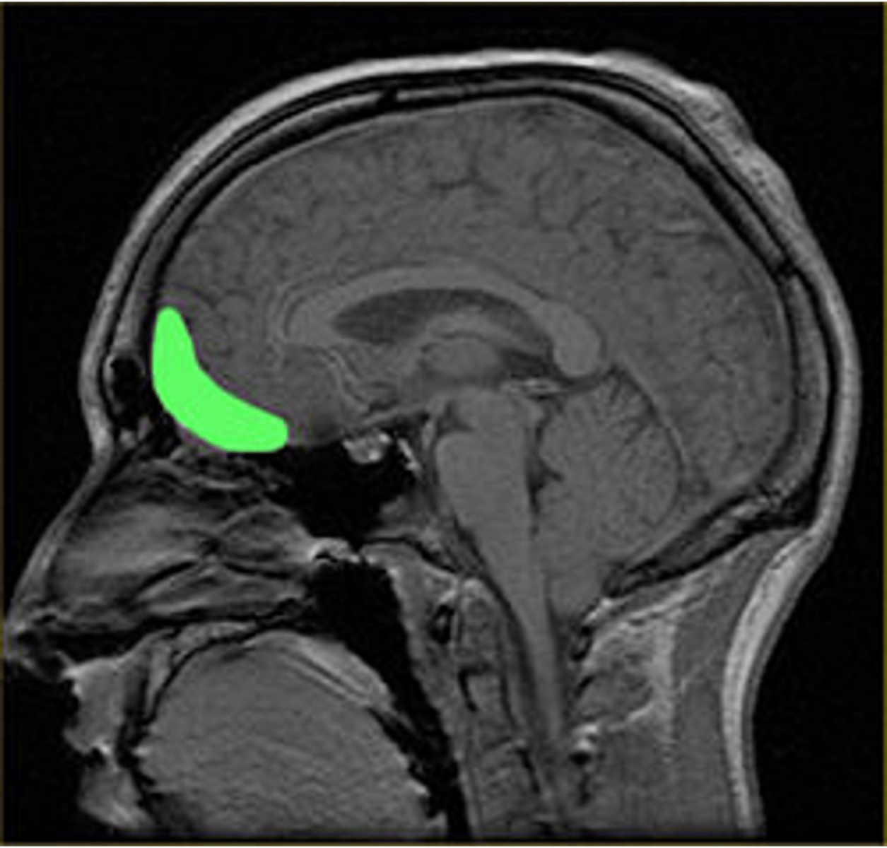 <p>What does the highlighted part of this image (in green) represent?</p>