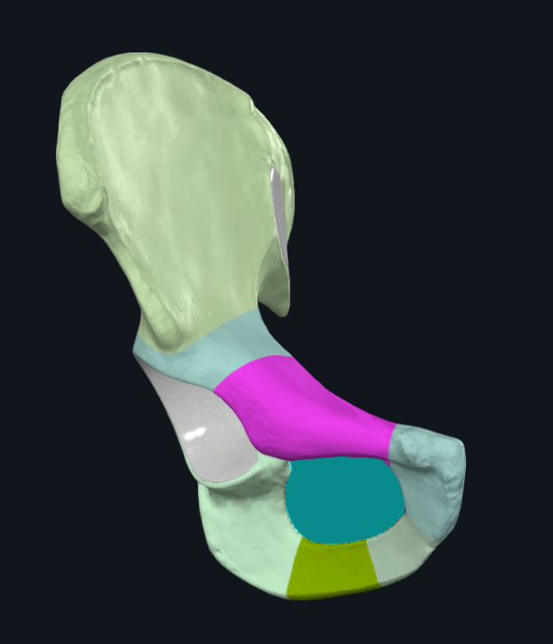 <p>What is highlighted pink</p>