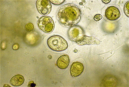 <p>What is the <u><strong>Domain, Kingdom, and Phylum</strong></u> of <u><strong>this organism</strong></u>?</p>