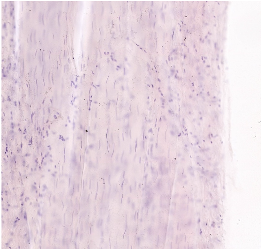 <p>Classify the predominant CT in the field of view.</p>