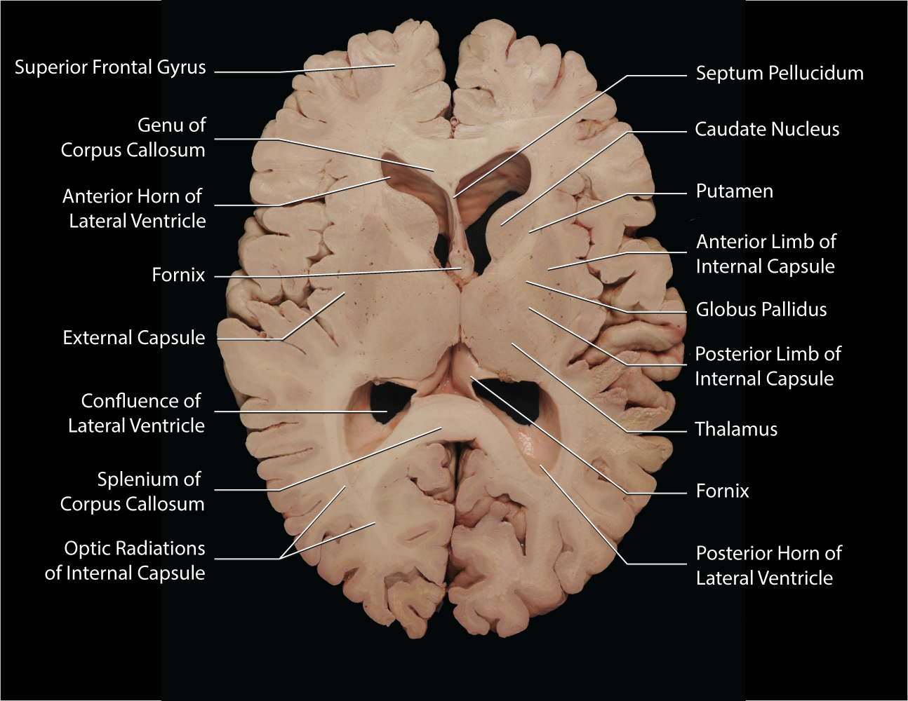 <p>-Dorsal and Ventral</p>