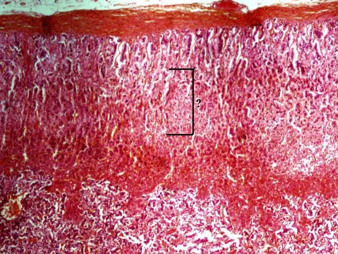 <p><span><span>Identify the indicated layer of the adrenal gland.</span></span></p>