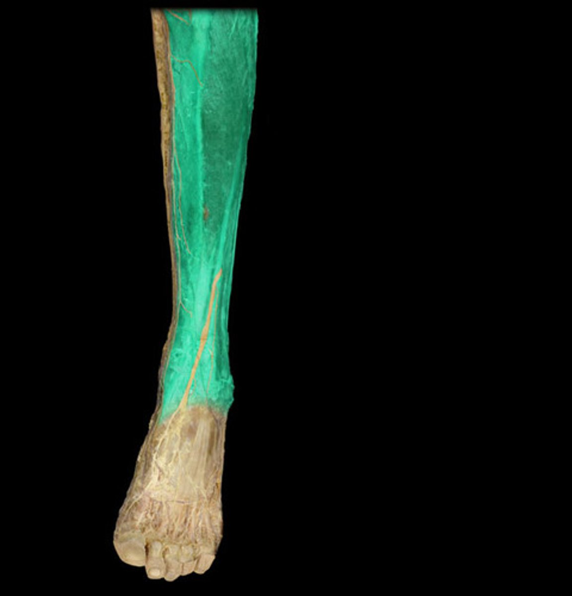 <p>Front of leg (Shin).</p>