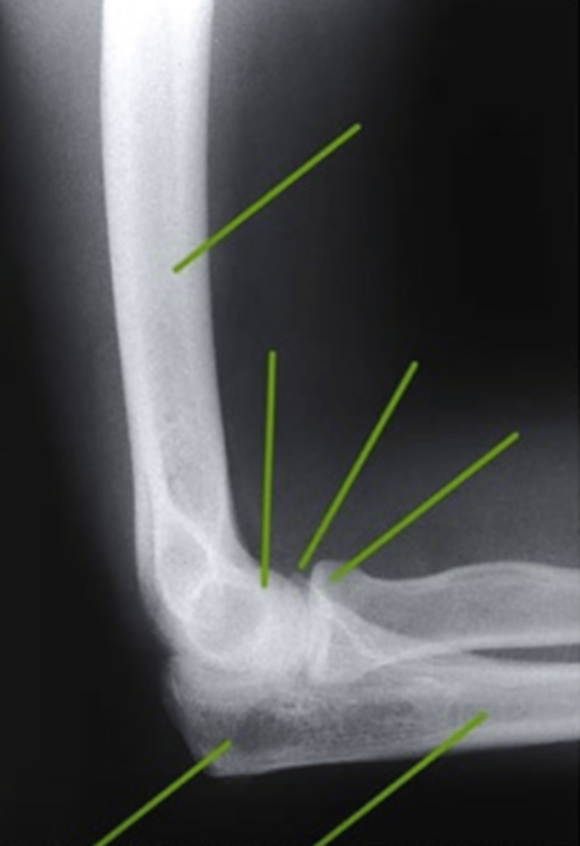 <p>what view is this</p>