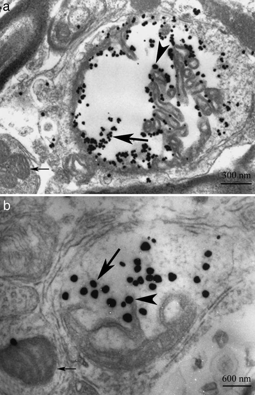 Immuno-gold electron microscopy