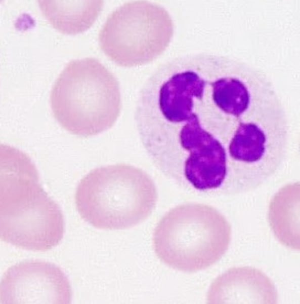 <p>Most common type of granulocyte in blood. Uses phagocytosis to engulf and destroy pathogens.</p>