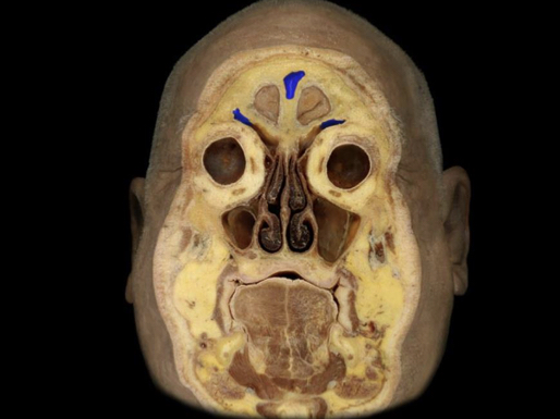 What structure is highlighted in blue?