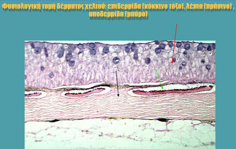 <p>επιδερμιδα (επιθηλιακα, πλακωδη, βλενογονα κυτ) ΟΧΙ ΚΕΡΑΤΙΝΟΚΥΤΤΑΡΑ</p><p>χοριο (λεπια, δηλητηριο, χρωμα)</p><p>υποδοριος ιστος (υποδερμικα)</p>