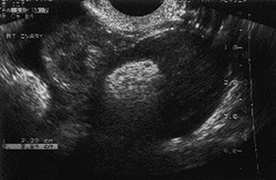 <p>What is this US image?</p>