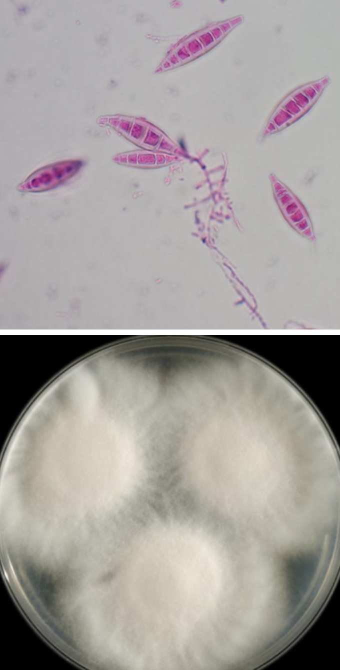 <p>Microsporum canis</p>