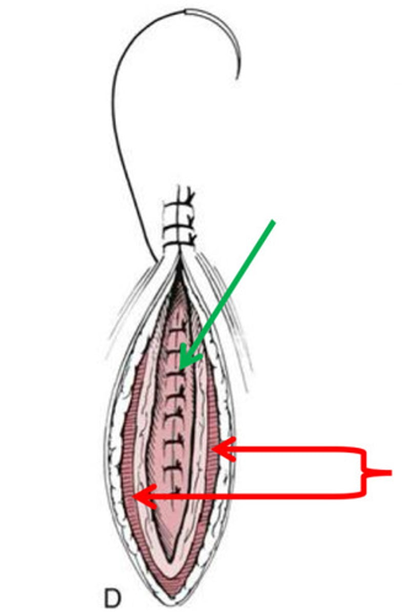 <p>This is illustrating a urethrotomy closure. How would urethrostomy closure be different?</p>