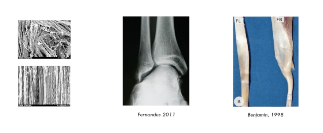 <ul><li><p>tendinopathy = load </p></li><li><p>photo 1:</p><ul><li><p>injured tendon with collagen fibers all over the pale, theres no organization </p></li><li><p>extracellular matrix leads to unorganized of collagen while laying down </p></li><li><p>realign collagen fibers </p></li><li><p>lay down and respond to load </p></li></ul></li><li><p>photo 2: </p><ul><li><p>this person had eversion</p></li><li><p>their body adapted to force over time and have this acetabularized talocrual joint </p></li></ul></li><li><p>photo 3: size difference with load and without</p></li></ul><p></p>
