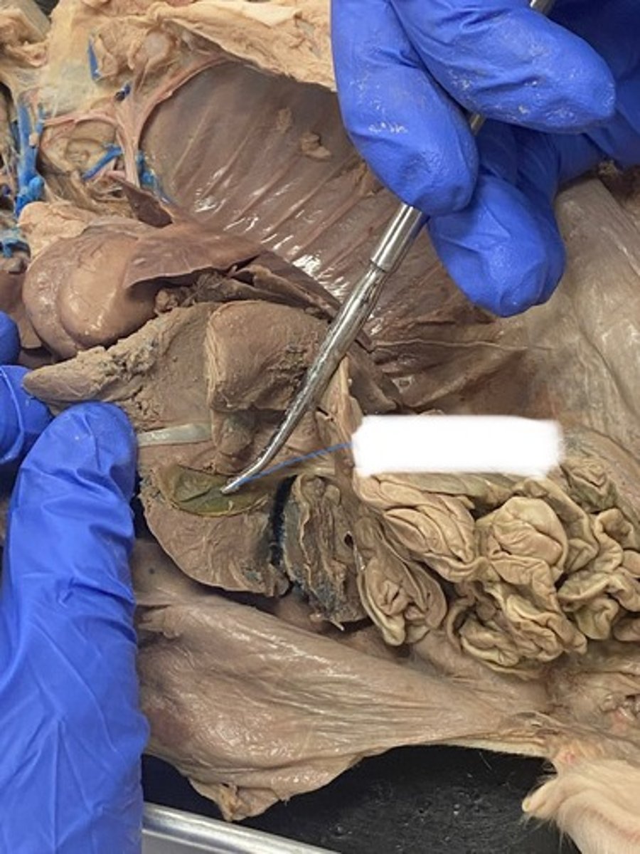 <p>What system does the Gallbladder belong to?</p>