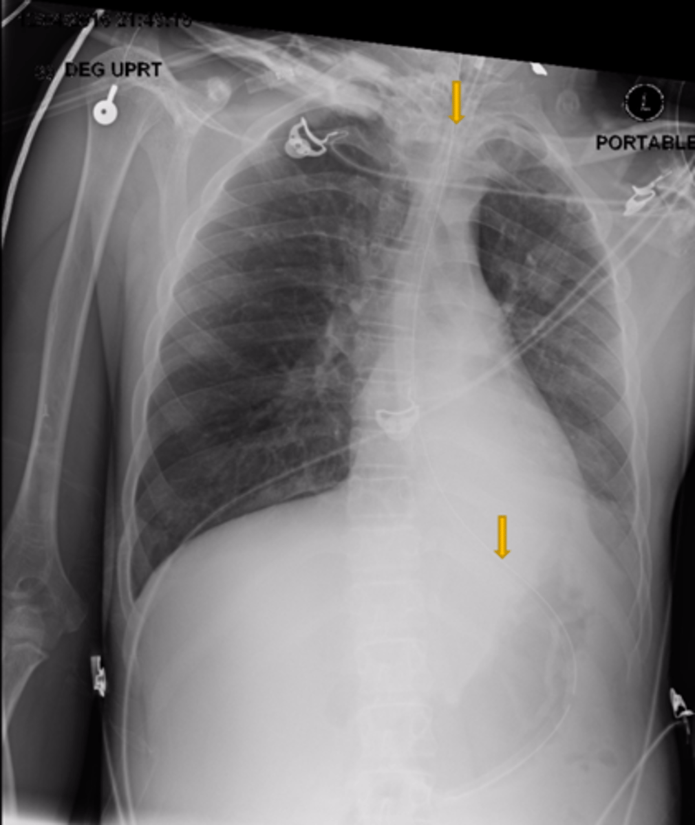 <p>Is this patient rotated?</p>