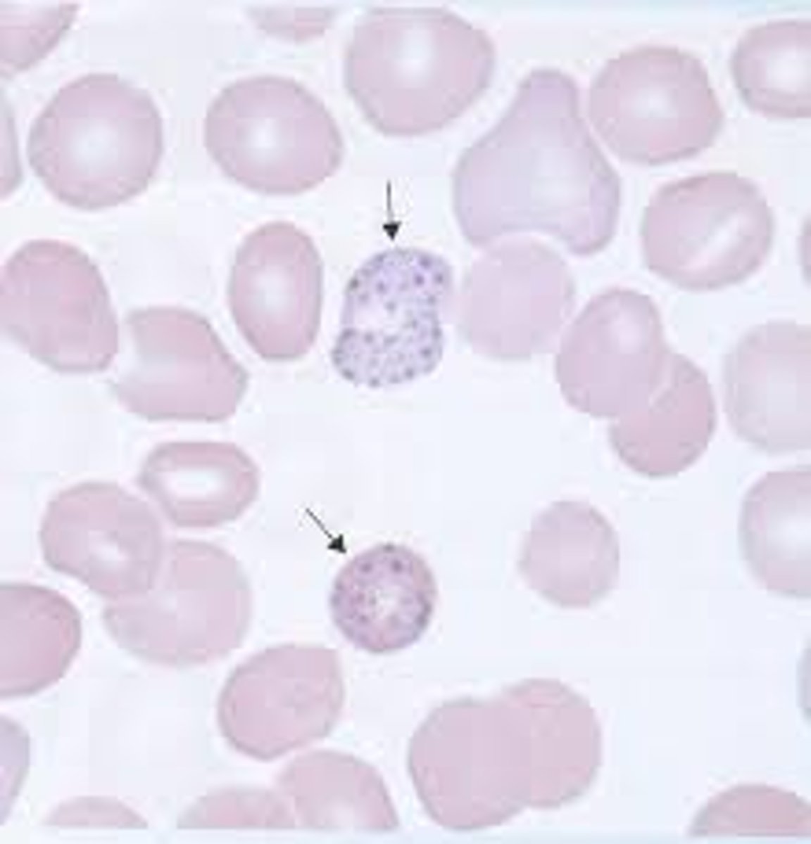 <p>Ribosomal/RNA remnants (looks like pepper); lead poisoning, thalassemia</p>