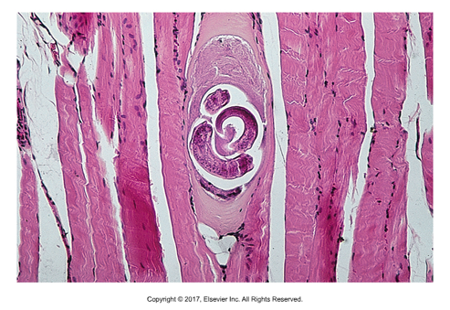 <p>"Small hair"</p><ul><li><p>Pigs are intermediate AND definitive host​</p></li><li><p>Adults in small intestine​</p></li><li><p>Found: Worldwide (except for Australia and Denmark)​</p></li><li><p>Cause of infection: Ingestion of contaminated, undercooked pork​</p></li><li><p>Zoonotic​</p></li><li><p>Female 4mm long, male is smaller​</p></li><li><p>Larvated egg​</p></li><li><p>Domestic animals often asymptomatic​</p></li><li><p>Larvae encyst in skeletal muscle​</p></li><li><p>Diagnosed by muscle biopsy</p></li></ul><p></p>