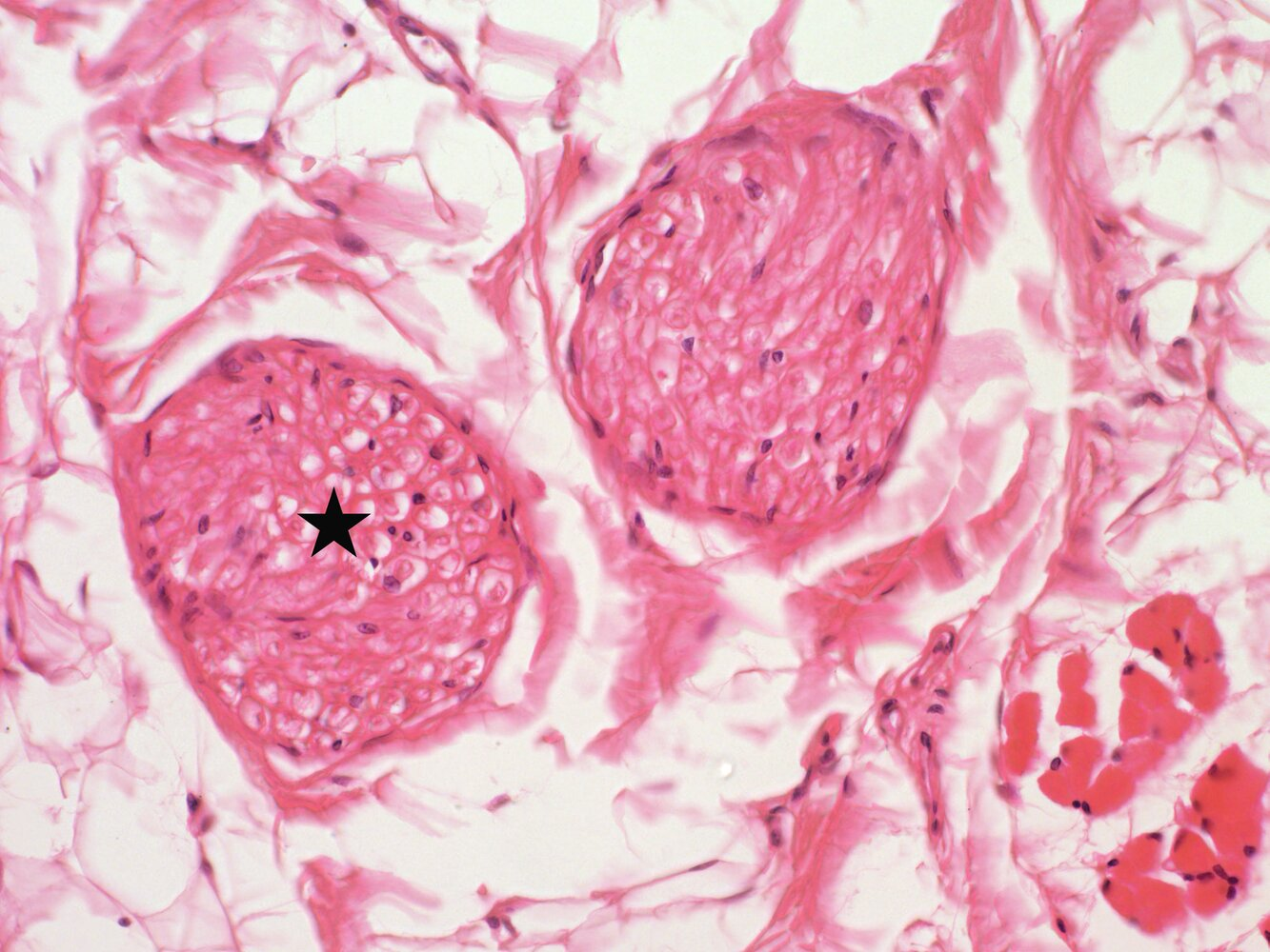<p>11. The structure marked with a star in the image is:</p><p>A. A blood vessel with red blood cells</p><p>B. A bundle of smooth muscle cells</p><p>C. A peripheral nerve</p><p>D. A primary bundle of skeletal muscle fibers</p><p>E. A tendon fiber bundle</p>