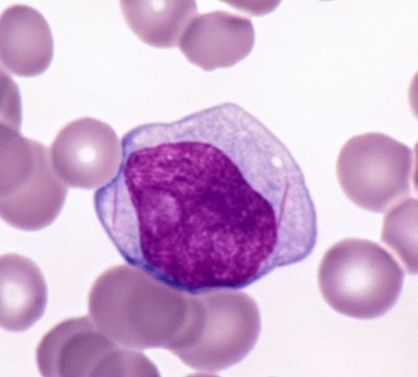 <p>seen in blood smear</p>