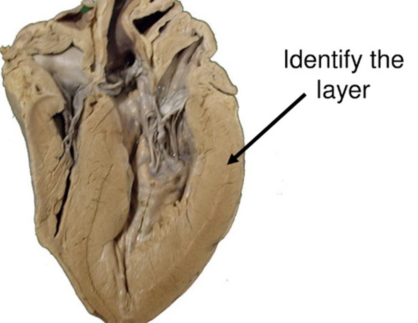 <p>term for heart muscle; middle layer; linked through gap junctions</p>