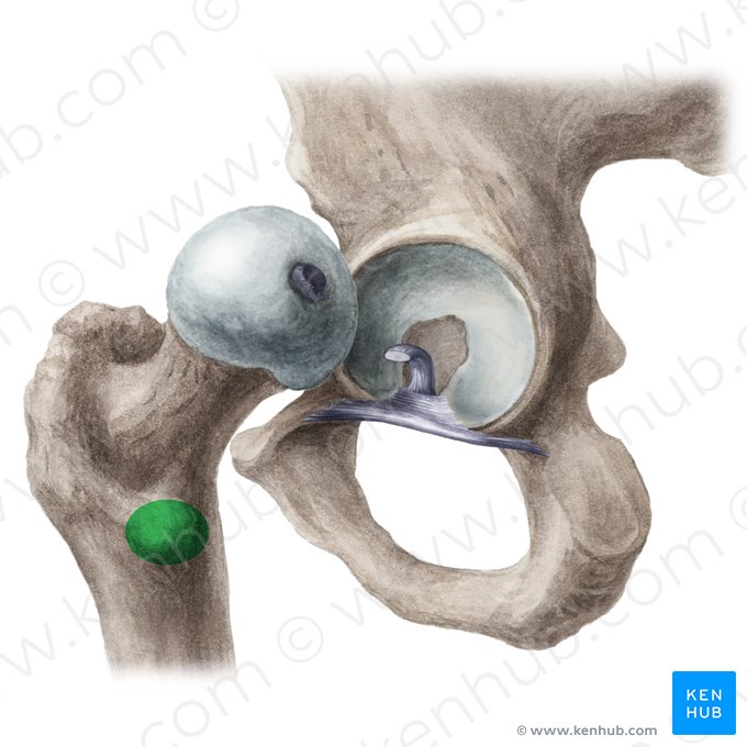 <p>Femur: Bone Location</p>