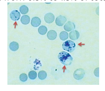 <p>Reticulocyte Count <span data-name="drop_of_blood" data-type="emoji">🩸</span></p>