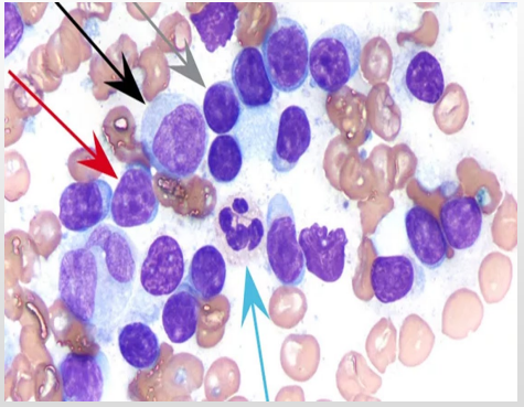 <p>Normal lymph node morphological features</p><p>Look at the arrows, features for each?</p>