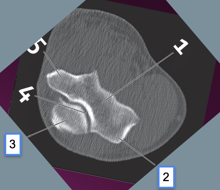 <p>4</p>