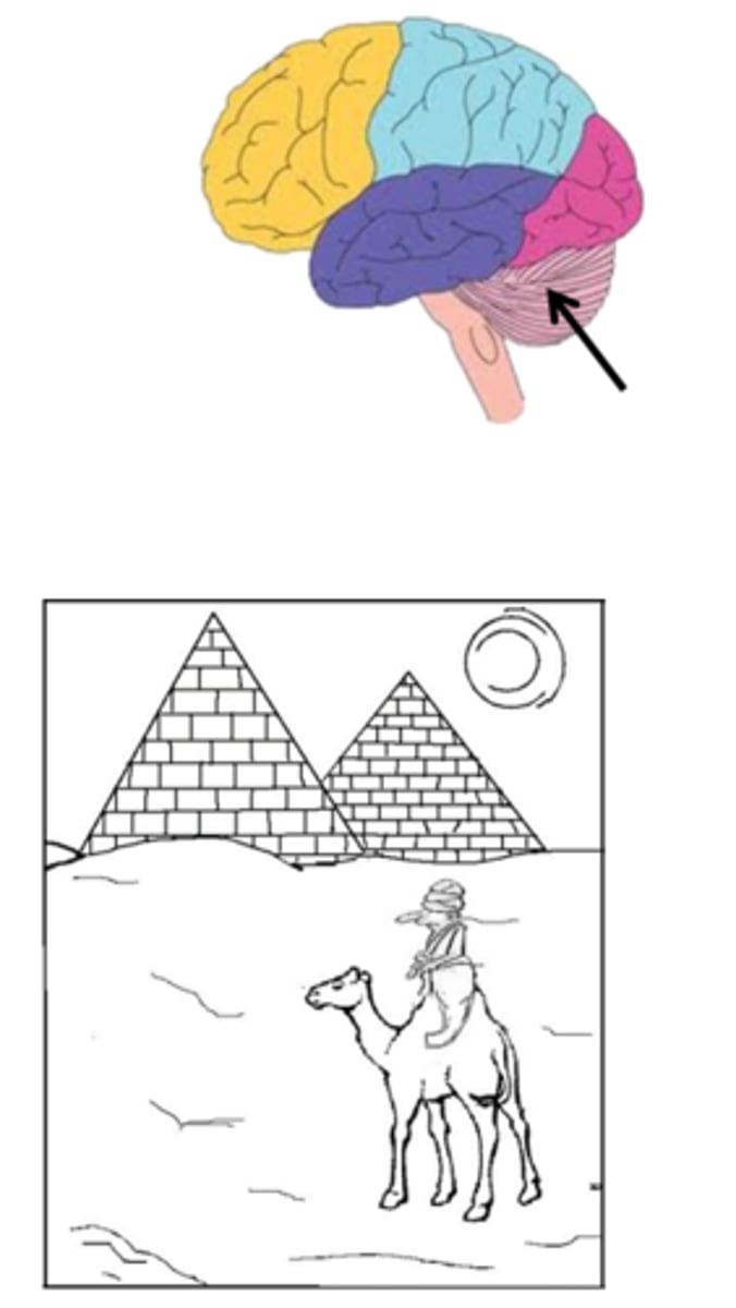 <p>a deficit in scene perception where the patient can see multiple objects, but cannot recognize them (can navigate and count, but cannot read)</p>