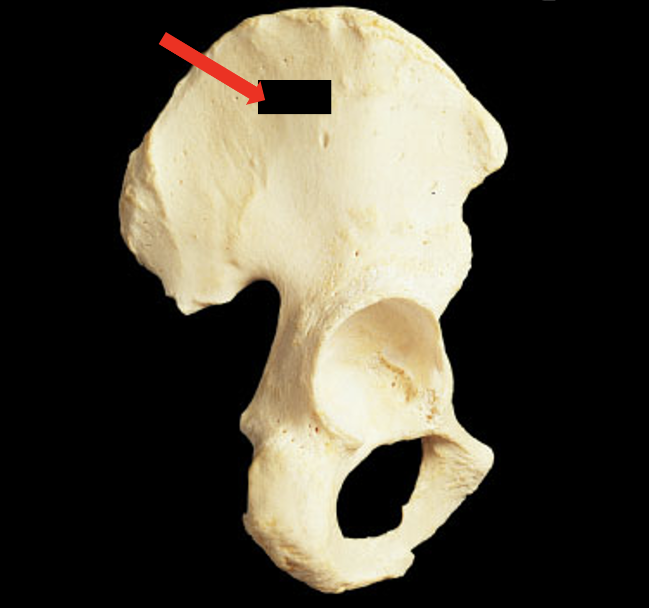 Name this region of the pelvis