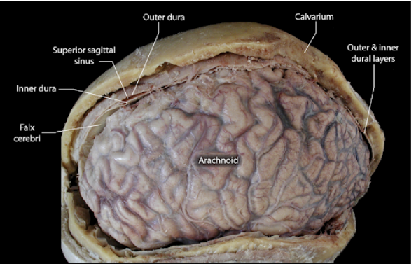 <p>What is this showing?</p>