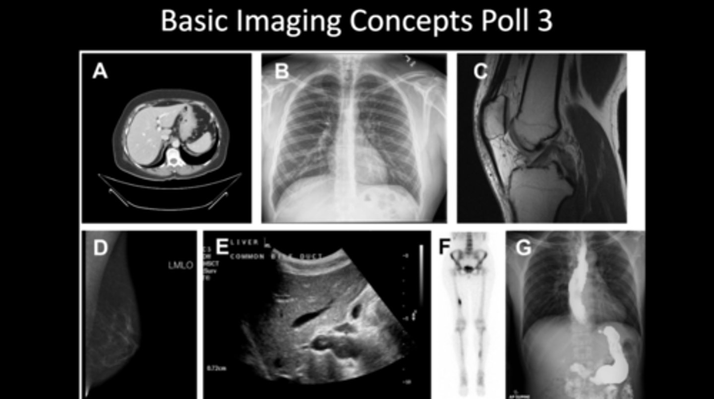 <p>a. MRI</p><p>b. XRAY</p><p>c. MRI</p><p>d. MAMMO</p><p>e. ULTRASOUND</p><p>f. DEXA</p><p>g. CT contrast study</p>