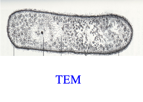 <p><span style="font-family: &quot;Times New Roman&quot;;">looks through the cells or sections of cells</span></p><p><span style="font-family: &quot;Times New Roman&quot;;">2D</span></p><p><span style="font-family: &quot;Times New Roman&quot;;">the best approach for looking at cell structure ( all organelles)</span></p><p></p>