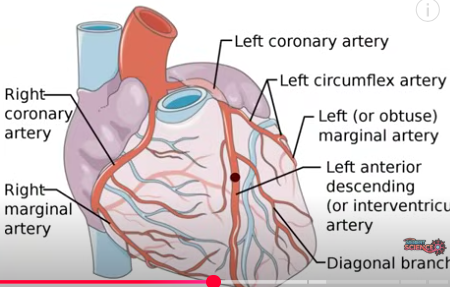 <p>coronary arteries which branch off from the aorta</p>