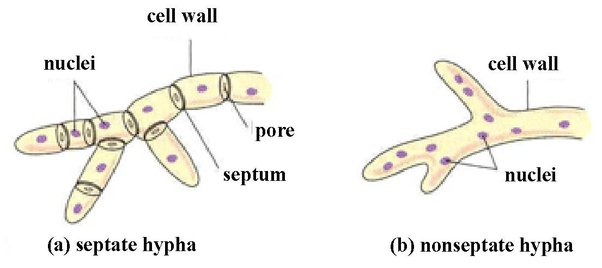 <p>Septa  (Ch. 2)</p>