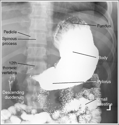 <p>What position is this patient in?</p>