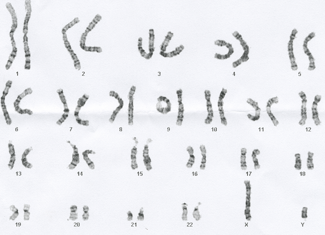 Male karyotype