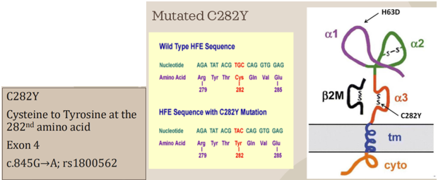 <p><span style="font-family: &quot;Times New Roman&quot;, serif;"><span>Disease-causing mutations:</span></span></p><p class="MsoListParagraphCxSpFirst"><span style="font-family: Aptos, sans-serif;"><span>-</span></span><span style="font-family: &quot;Times New Roman&quot;; line-height: normal; font-size: 7pt;"><span>&nbsp;&nbsp;&nbsp;&nbsp;&nbsp;&nbsp;&nbsp;&nbsp;&nbsp; </span></span><span style="font-family: &quot;Times New Roman&quot;, serif;"><span>The most common mutation responsible for HH is the substitution of tyrosine for cysteine at the 282</span><sup><span>nd</span></sup><span> amino acid position in the protein sequence (C282Y mutation)</span></span></p><p class="MsoListParagraphCxSpMiddle"><span style="font-family: &quot;Courier New&quot;;"><span>o</span></span><span style="font-family: &quot;Times New Roman&quot;; line-height: normal; font-size: 7pt;"><span>&nbsp;&nbsp; </span></span><span style="font-family: &quot;Times New Roman&quot;, serif;"><span>Found in 10% of Caucasian population</span></span></p><p class="MsoListParagraphCxSpMiddle"><span style="font-family: Aptos, sans-serif;"><span>-</span></span><span style="font-family: &quot;Times New Roman&quot;; line-height: normal; font-size: 7pt;"><span>&nbsp;&nbsp;&nbsp;&nbsp;&nbsp;&nbsp;&nbsp;&nbsp;&nbsp; </span></span><span style="font-family: &quot;Times New Roman&quot;, serif;"><span>The cysteine residue at this position is part of a disulfide bond that forms a loop in the alpha-3 domain of the HFE protein</span></span></p><p class="MsoListParagraphCxSpMiddle"><span style="font-family: Aptos, sans-serif;"><span>-</span></span><span style="font-family: &quot;Times New Roman&quot;; line-height: normal; font-size: 7pt;"><span>&nbsp;&nbsp;&nbsp;&nbsp;&nbsp;&nbsp;&nbsp;&nbsp;&nbsp; </span></span><span style="font-family: &quot;Times New Roman&quot;, serif;"><span>When cysteine 282 is lost, the disulfide bond cannot be formed and the hfe protein’s alpha-3 domain is no longer able to complex with beta-2-microglobulin, which serves as a stabilization factor</span></span></p><p class="MsoListParagraphCxSpLast"><span style="font-family: Aptos, sans-serif;"><span>-</span></span><span style="font-family: &quot;Times New Roman&quot;; line-height: normal; font-size: 7pt;"><span>&nbsp;&nbsp;&nbsp;&nbsp;&nbsp;&nbsp;&nbsp;&nbsp;&nbsp; </span></span><span style="font-family: &quot;Times New Roman&quot;, serif;"><span>As a result, the mutated HFE protein is degraded before it has a change to be incorporated into the cell membrane</span></span></p>