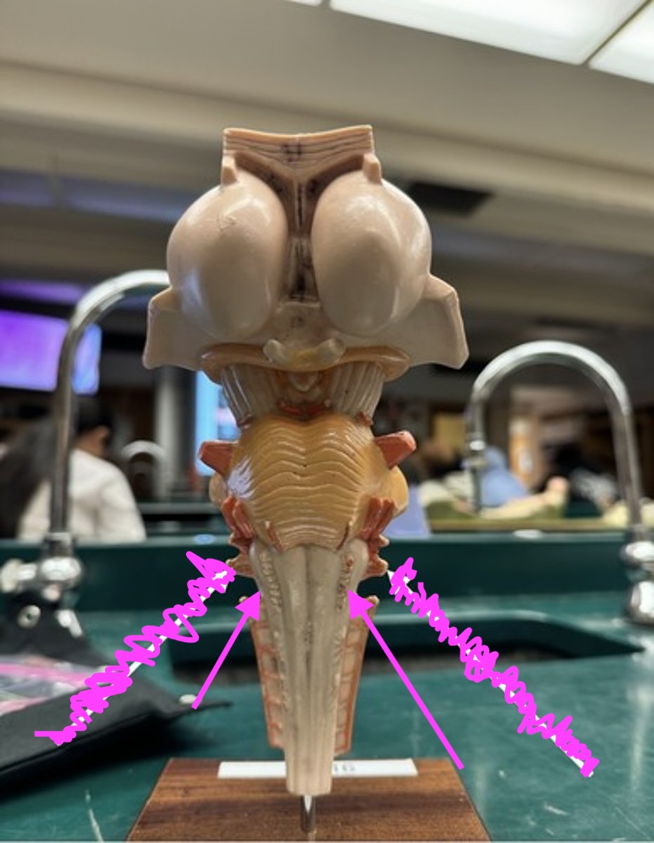 <p>identify arrow</p>