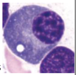 <p>What type of cell is seen here?</p>
