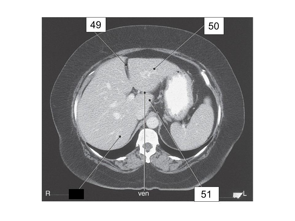 <p>identify 51</p>