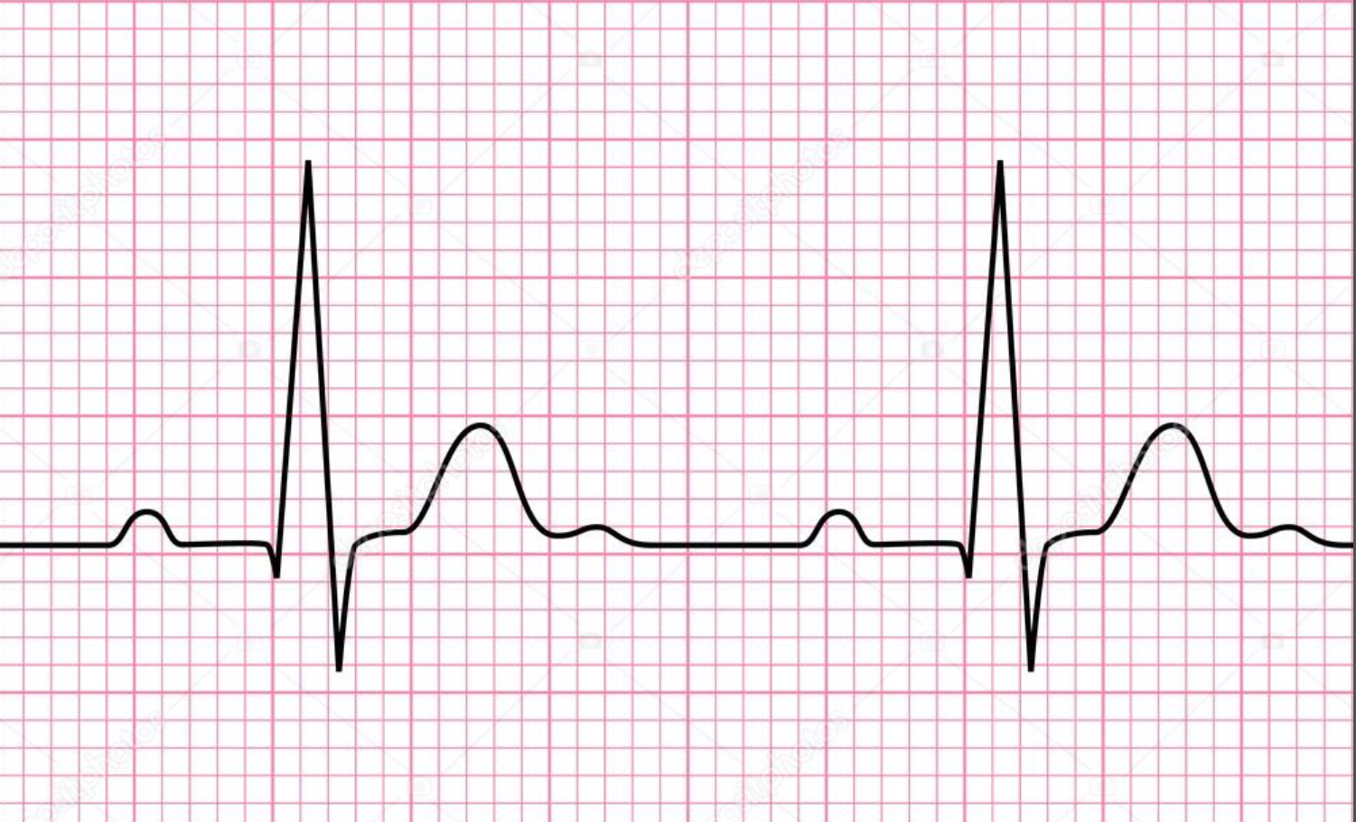 <ul><li><p>ventricular repolarization </p></li></ul>